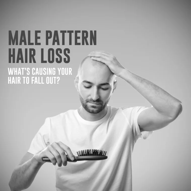 male pattern baldness mpb alopecia in men what cause male pattern hair loss