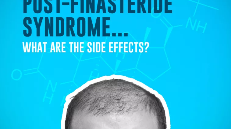what are the side effects of finasteride and post finasteride syndrome